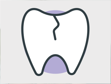 Cracked Tooth