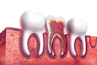 When And Why Root Canals Are Necessary